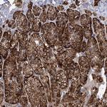 FAM82A1 Antibody in Immunohistochemistry (Paraffin) (IHC (P))