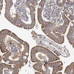 FAM82A1 Antibody in Immunohistochemistry (Paraffin) (IHC (P))