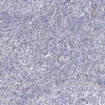 FAM82A1 Antibody in Immunohistochemistry (Paraffin) (IHC (P))