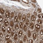 FAM119A Antibody in Immunohistochemistry (IHC)