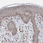 FAM119A Antibody in Immunohistochemistry (IHC)