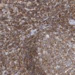 PSD4 Polyclonal Antibody