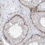 PHOSPHO2 Antibody in Immunohistochemistry (Paraffin) (IHC (P))