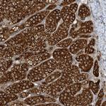C2orf43 Antibody in Immunohistochemistry (Paraffin) (IHC (P))