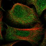 C3orf38 Polyclonal Antibody