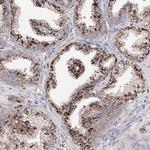 C3orf38 Antibody in Immunohistochemistry (Paraffin) (IHC (P))