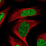 KHSRP Polyclonal Antibody