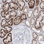 TBC1D7 Antibody in Immunohistochemistry (IHC)