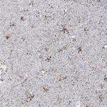 TBC1D7 Antibody in Immunohistochemistry (IHC)