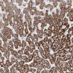 TBC1D7 Antibody in Immunohistochemistry (IHC)
