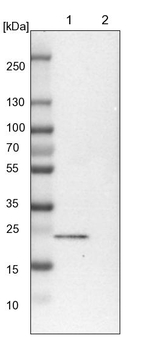 TBC1D7 Antibody in Western Blot (WB)