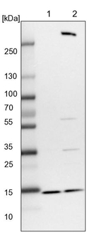 RBP7 Antibody in Western Blot (WB)