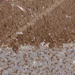 SLC4A10 Antibody in Immunohistochemistry (Paraffin) (IHC (P))