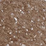 SLC4A10 Antibody in Immunohistochemistry (Paraffin) (IHC (P))