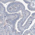 SLC4A10 Antibody in Immunohistochemistry (Paraffin) (IHC (P))