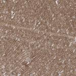 Bassoon Antibody in Immunohistochemistry (Paraffin) (IHC (P))