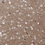 Bassoon Antibody in Immunohistochemistry (Paraffin) (IHC (P))