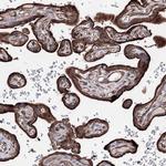 GFM1 Antibody in Immunohistochemistry (IHC)