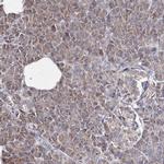 GFM1 Antibody in Immunohistochemistry (IHC)