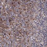 GFM1 Antibody in Immunohistochemistry (IHC)