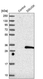 DGUOK Polyclonal Antibody