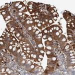 ARMH1 Polyclonal Antibody