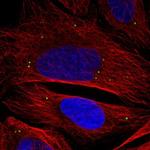 ADAMTSL3 Polyclonal Antibody