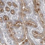 ADAMTSL3 Antibody in Immunohistochemistry (Paraffin) (IHC (P))