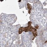 ADAMTSL3 Antibody in Immunohistochemistry (Paraffin) (IHC (P))