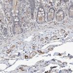 ADAMTSL3 Polyclonal Antibody