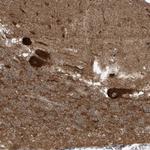 TRIM67 Antibody in Immunohistochemistry (Paraffin) (IHC (P))