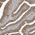 TRIM67 Polyclonal Antibody