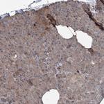 JIP2 Polyclonal Antibody