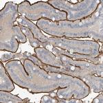 ZNF793 Polyclonal Antibody