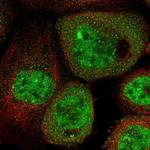 C13orf7 Polyclonal Antibody