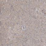 C13orf7 Antibody in Immunohistochemistry (IHC)