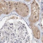 C13orf7 Antibody in Immunohistochemistry (IHC)