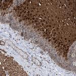 ZNF8 Antibody in Immunohistochemistry (Paraffin) (IHC (P))