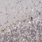 ZNF8 Antibody in Immunohistochemistry (Paraffin) (IHC (P))