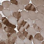 TTC15 Antibody in Immunohistochemistry (Paraffin) (IHC (P))