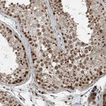 TTC15 Polyclonal Antibody