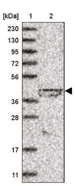 LIPT1 Antibody in Western Blot (WB)