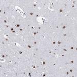 ZC3H8 Antibody in Immunohistochemistry (Paraffin) (IHC (P))