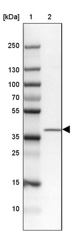ZC3H8 Antibody in Western Blot (WB)