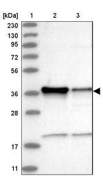 ZC3H8 Antibody in Western Blot (WB)