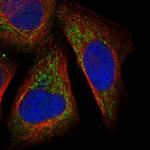 DHX30 Polyclonal Antibody