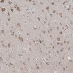 DHX30 Antibody in Immunohistochemistry (Paraffin) (IHC (P))
