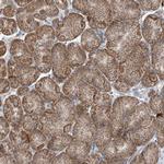 DHX30 Antibody in Immunohistochemistry (Paraffin) (IHC (P))