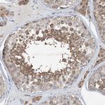 DHX30 Antibody in Immunohistochemistry (Paraffin) (IHC (P))