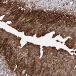 ACAP2 Polyclonal Antibody